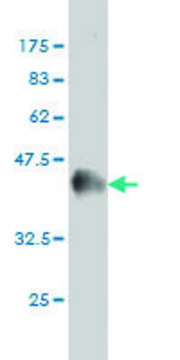 Monoclonal Anti-MCC antibody produced in