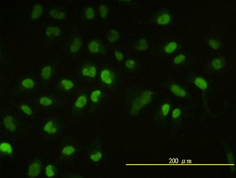 Monoclonal Anti-UBE2H antibody produced in