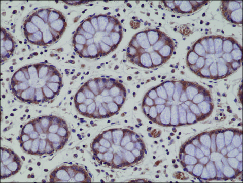 Anti-AMPK alpha-1antibody, Rabbit Monoclonal