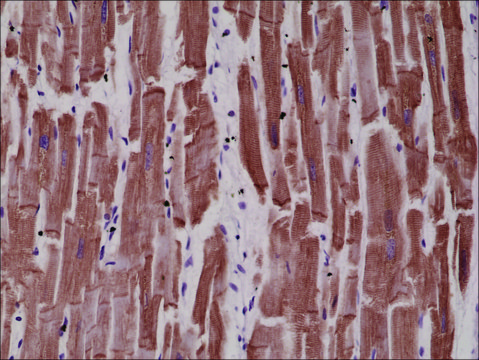 Anti-Desmin antibody, Rabbit monoclonal