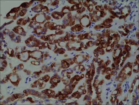 Anti-TPO (Thyroid Peroxidase) antibody, Rabbit