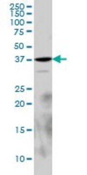 Monoclonal Anti-EPM2A antibody produced in