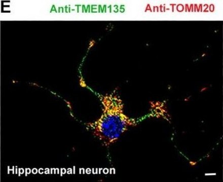 Monoclonal Anti-TOMM20 antibody produced in