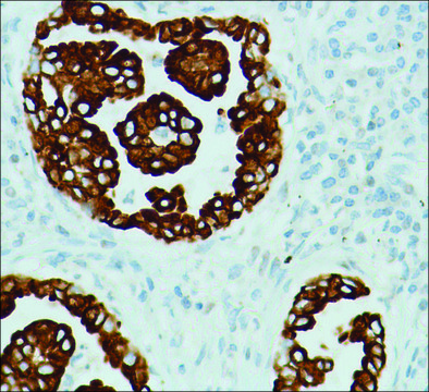 Anti-RRM1 antibody, Rabbit monoclonal