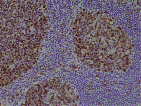 Anti-Stathmin (CTMN1) antibody, Rabbit monoclonal