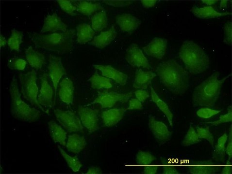 Monoclonal Anti-GLS antibody produced in