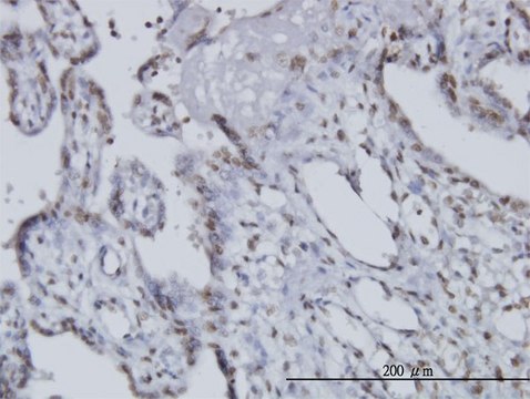Monoclonal Anti-CCRN4L antibody produced in