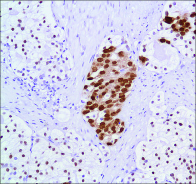 Anti-Androgen Receptor antibody, Rabbit monoclonal