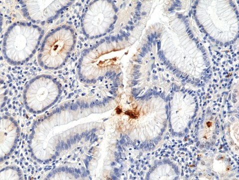 Anti-Helicobacter Pylori (H.Pylori) Rabbit Monoclonal