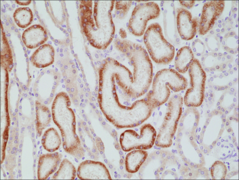 Anti-p504s/AMACR antibody, Rabbit monoclonal
