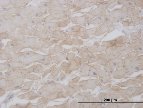 Monoclonal Anti-SGCB antibody produced in