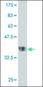 Monoclonal Anti-TMPRSS13 antibody produced in
