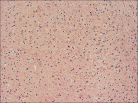 Monoclonal Anti-KCNB2 antibody produced in