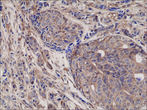Anti-NFKB p65 antibody, Rabbit monoclonal