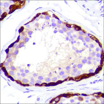 Anti-MAGE-A1 antibody, Rabbit monoclonal