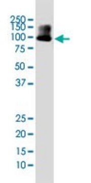 Monoclonal Anti-DYRK1A antibody produced in