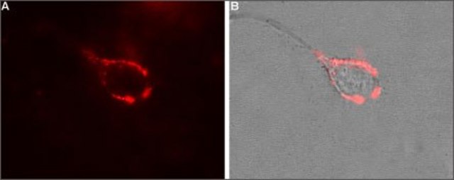 Anti-Calcium Channel (??/?-1 Subunit) antibody