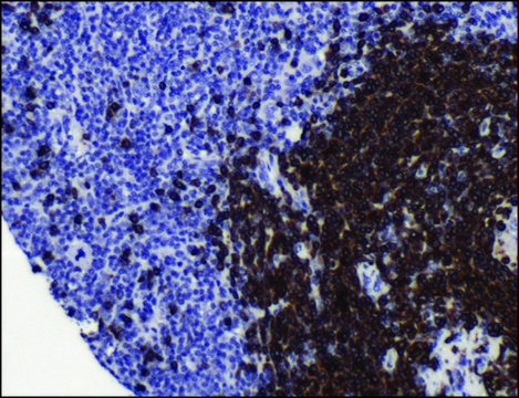 Anti-CD79A antibody, Rabbit monoclonal