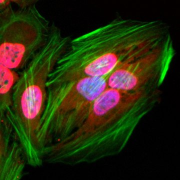 Anti-Acetylated-Lysine antibody, Rabbit monoclonal