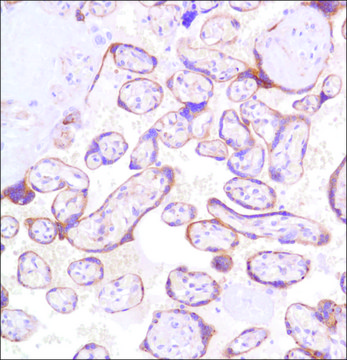 Anti-Glypican-3 antibody, Rabbit monoclonal