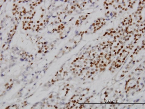 Monoclonal Anti-MCM7 antibody produced in
