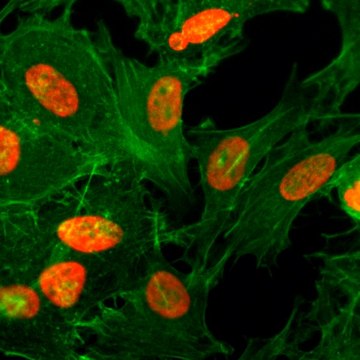 Anti-Acetyl-Histone H3 (Lys36) antibody, Rabbit