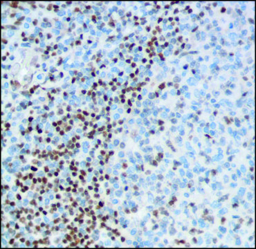 Anti-FOXP1 antibody, Rabbit monoclonal
