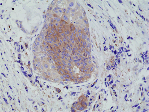 Anti-eIF-2 alpha (Ser51) antibody, Rabbit