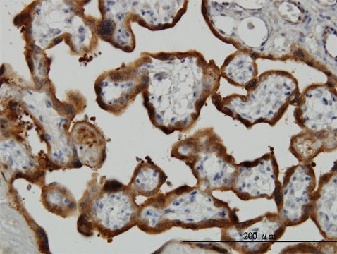 Monoclonal Anti-TGM2 antibody produced in