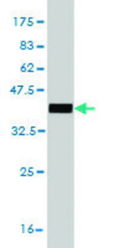 Monoclonal Anti-EPM2AIP1 antibody produced in