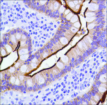 Anti-Villin antibody, Rabbit monoclonal