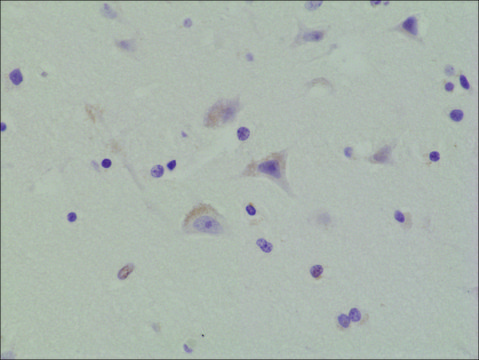 Anti-Phospho-AMPA Receptor antibody, GluR 1