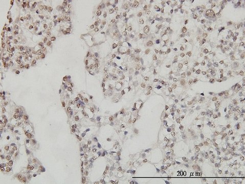 Monoclonal Anti-DDX54 antibody produced in