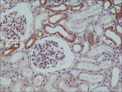 Anti-MYD88 antibody, Rabbit Monoclonal