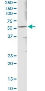 Monoclonal Anti-ALDH3A1 antibody produced in