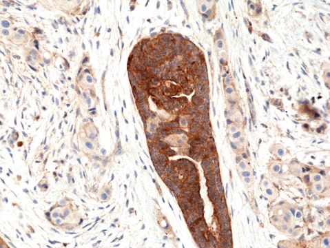 Anti-VEGF (VEGFA) Rabbit Monoclonal Antibody