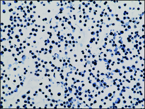 Anti-Dimethyl Histone H3 (Lys79) antibody,