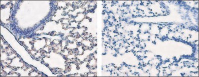 Anti-Water Channel Aquaporin 5 antibody
