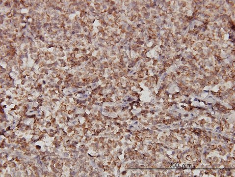Monoclonal Anti-STIM1 antibody produced in