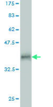 Monoclonal Anti-RNF17 antibody produced in