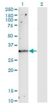 Monoclonal Anti-TIMP1 antibody produced in
