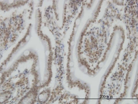 Monoclonal Anti-SP110 antibody produced in