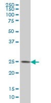 Monoclonal Anti-CMTM4 antibody produced in