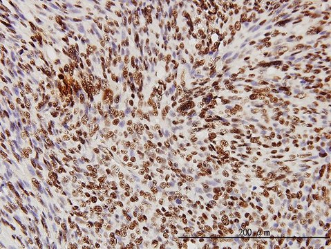 Monoclonal Anti-TARDBP antibody produced in