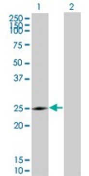Monoclonal Anti-NQO2 antibody produced in