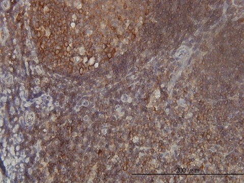 Monoclonal Anti-FARSLB antibody produced in