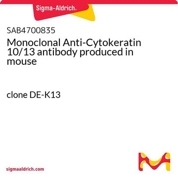 Monoclonal Anti-Cytokeratin 10/13 antibody produced