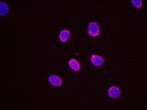 Estrogen Receptor Alpha and STUB1