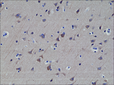 Anti-LC3B antibody, Rabbit Monoclonal