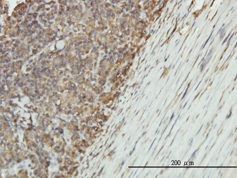 Monoclonal Anti-ENO1 antibody produced in